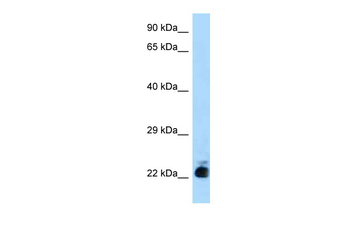 Slc31a1 Rabbit Polyclonal Antibody