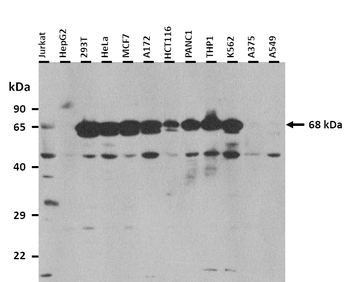 SLC7A1 Rabbit Polyclonal Antibody