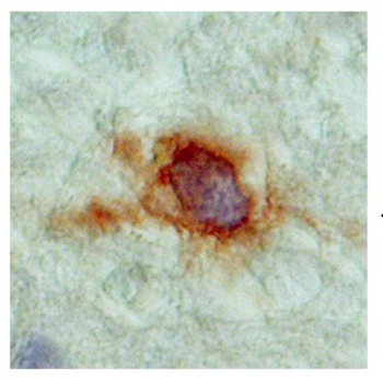 SLC18A2 Rabbit Polyclonal Antibody