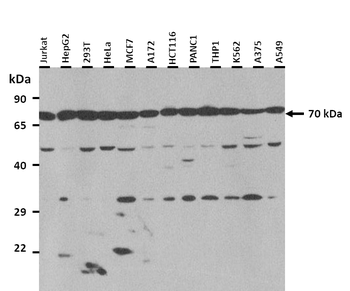 SLC27A2 Rabbit Polyclonal Antibody