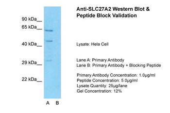 SLC27A2 Rabbit Polyclonal Antibody