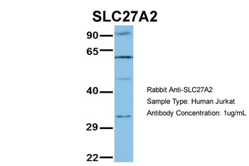 SLC27A2 Rabbit Polyclonal Antibody