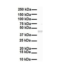 SLC27A2 Rabbit Polyclonal Antibody
