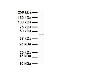 SLC27A2 Rabbit Polyclonal Antibody