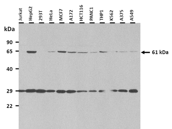 SLC33A1 Rabbit Polyclonal Antibody