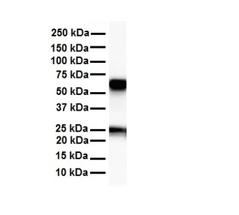 SLC33A1 Rabbit Polyclonal Antibody