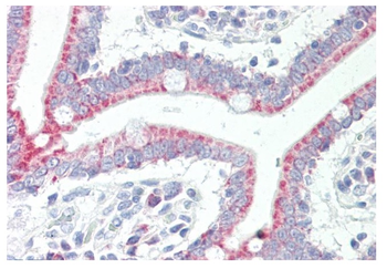 SLC33A1 Rabbit Polyclonal Antibody