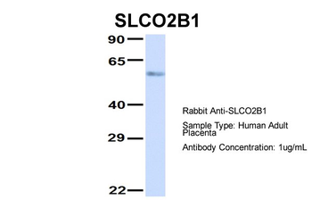 SLCO2B1 Rabbit Polyclonal Antibody