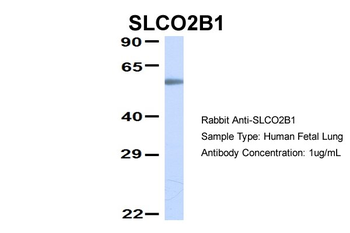SLCO2B1 Rabbit Polyclonal Antibody