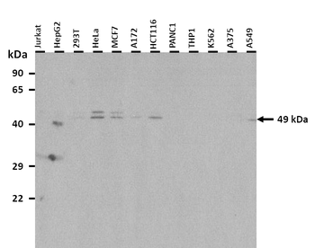 SLC39A6 Rabbit Polyclonal Antibody