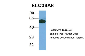 SLC39A6 Rabbit Polyclonal Antibody