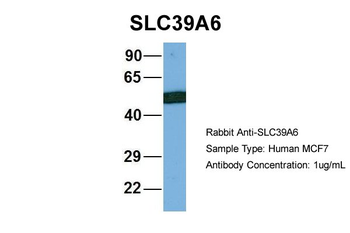 SLC39A6 Rabbit Polyclonal Antibody