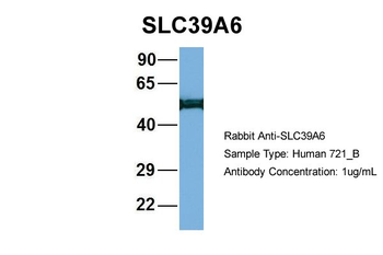SLC39A6 Rabbit Polyclonal Antibody