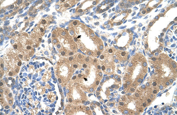 SLC39A6 Rabbit Polyclonal Antibody