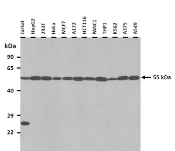 SLC30A1 Rabbit Polyclonal Antibody