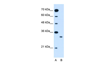SLC25A22 Rabbit Polyclonal Antibody