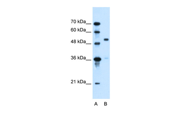 SLC37A3 Rabbit Polyclonal Antibody