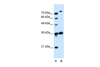 SLC9A7 Rabbit Polyclonal Antibody