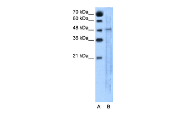 SLC25A46 Rabbit Polyclonal Antibody