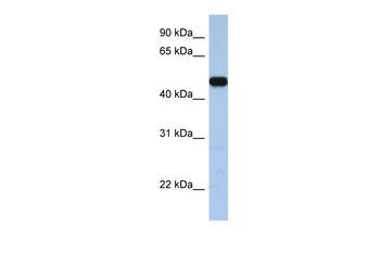 SLC25A46 Rabbit Polyclonal Antibody