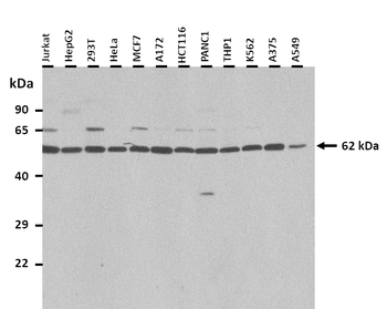 SLC15A4 Rabbit Polyclonal Antibody