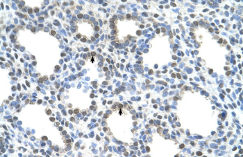 SLC15A4 Rabbit Polyclonal Antibody