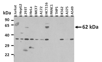 SLC15A4 Rabbit Polyclonal Antibody