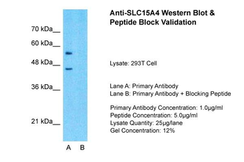 SLC15A4 Rabbit Polyclonal Antibody