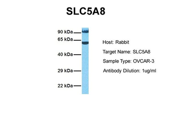 SLC5A8 Rabbit Polyclonal Antibody