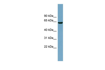 SLC5A8 Rabbit Polyclonal Antibody