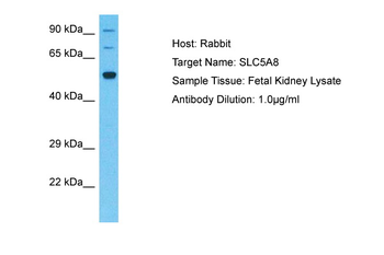 SLC5A8 Rabbit Polyclonal Antibody