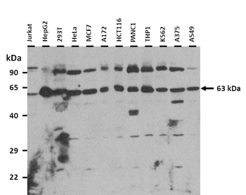 SLC13A5 Rabbit Polyclonal Antibody