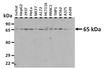 SLC19A1 Rabbit Polyclonal Antibody