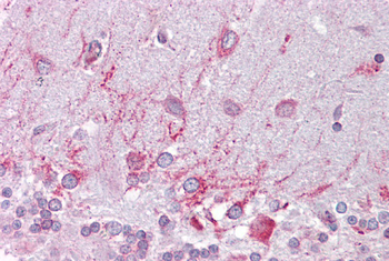 PSEN1 Rabbit Polyclonal Antibody