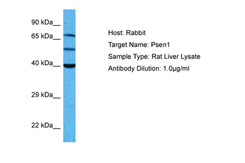PSEN1 Rabbit Polyclonal Antibody