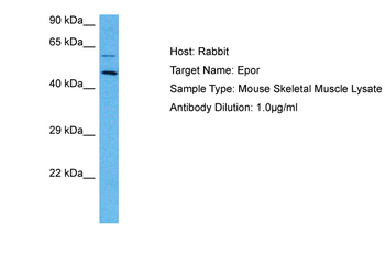 Epor Rabbit Polyclonal Antibody