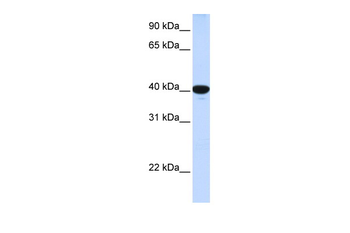 G6PC Rabbit Polyclonal Antibody