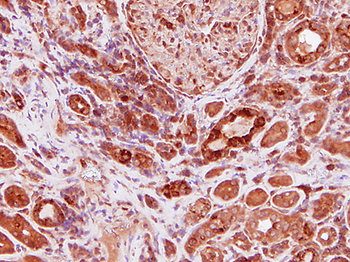 G6PC Rabbit Polyclonal Antibody