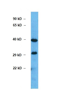G6PC Rabbit Polyclonal Antibody
