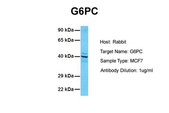 G6PC Rabbit Polyclonal Antibody