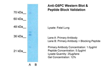 G6PC Rabbit Polyclonal Antibody