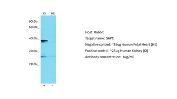 G6PC Rabbit Polyclonal Antibody