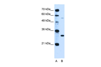 HFE Rabbit Polyclonal Antibody