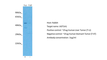 UGT1A1 Rabbit Polyclonal Antibody