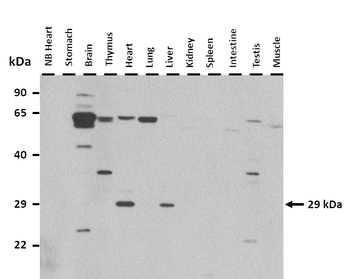 Aqp2 Rabbit Polyclonal Antibody