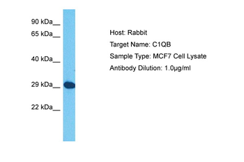 C1QB Rabbit Polyclonal Antibody