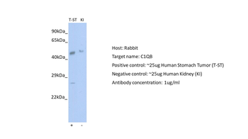 C1QB Rabbit Polyclonal Antibody