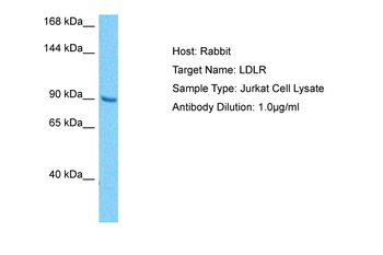 LDLR Rabbit Polyclonal Antibody