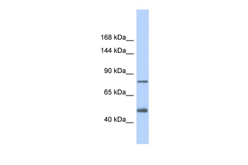 LDLR Rabbit Polyclonal Antibody