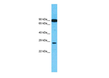 HGF Rabbit Polyclonal Antibody
